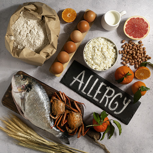 food allergens